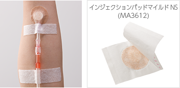 インジェクションパッドマイルドNS（MA3612）